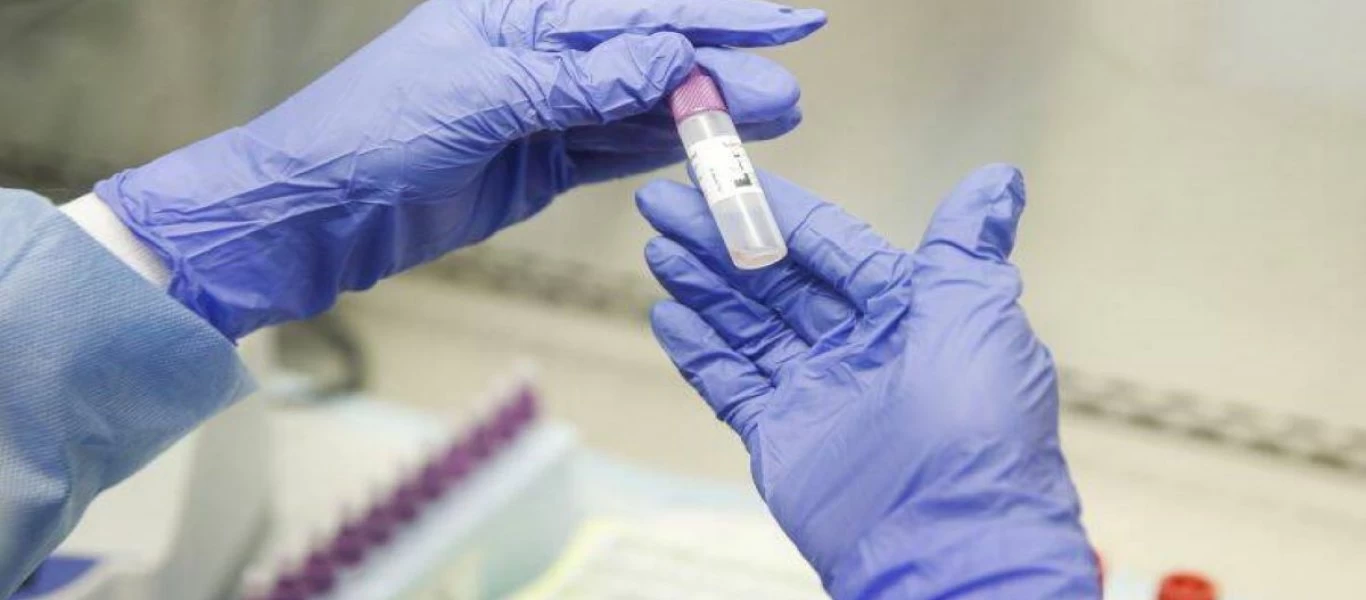 Κορωνοϊός: Ξεκινούν δοκιμές στην Βρετανία σε 5.000 αρρώστους με πλάσμα αίματος από ασθενείς που έχουν αναρρώσει